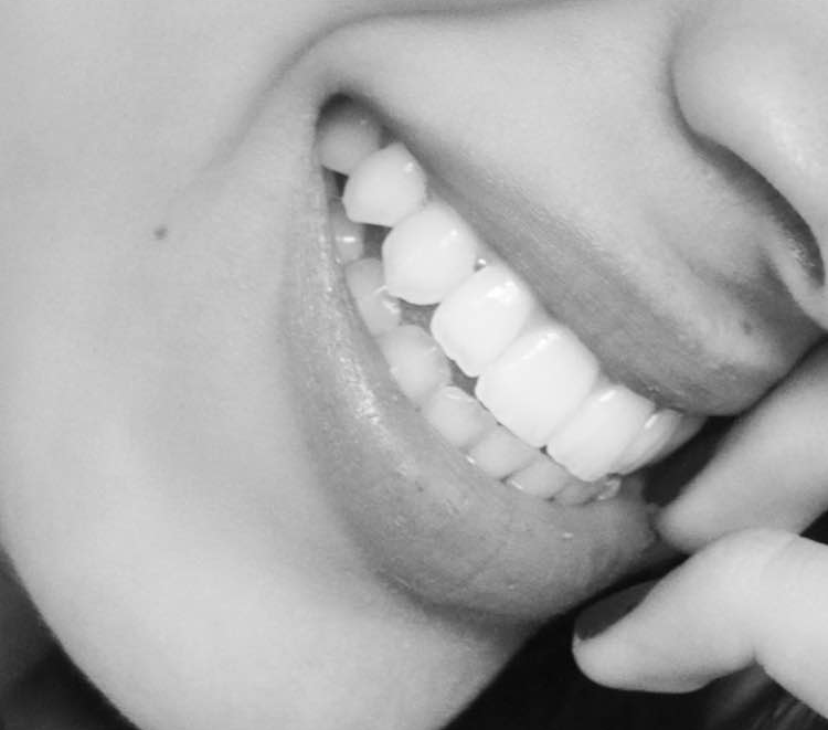Estética dental